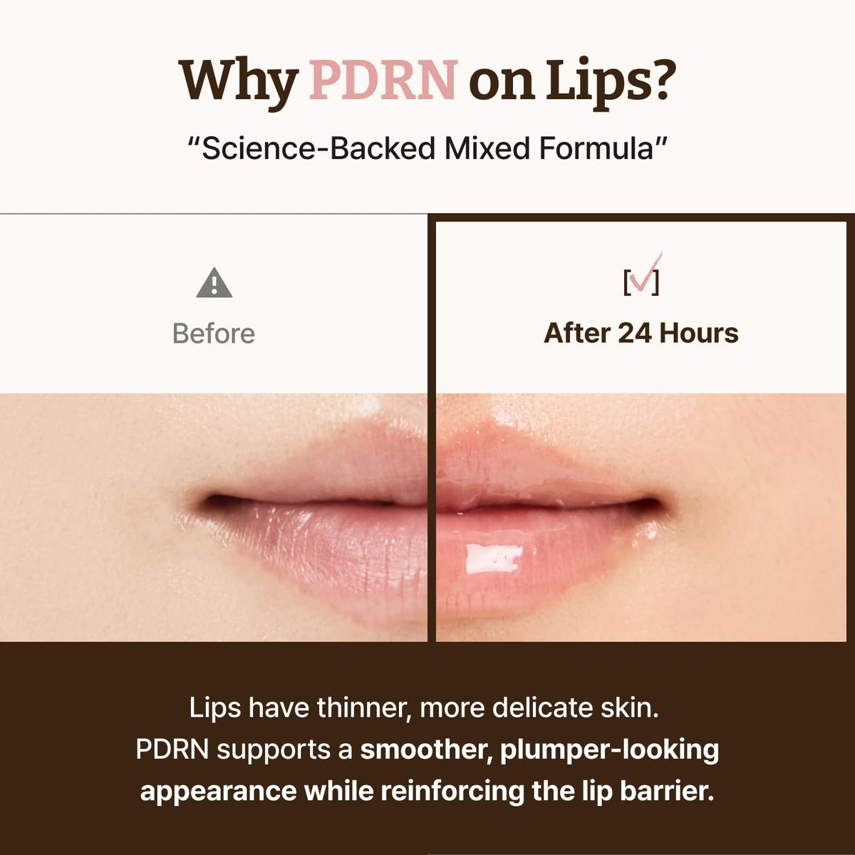 Packaging of Dr.Reju-All Advanced PDRN Rejuvenating Lip Serum