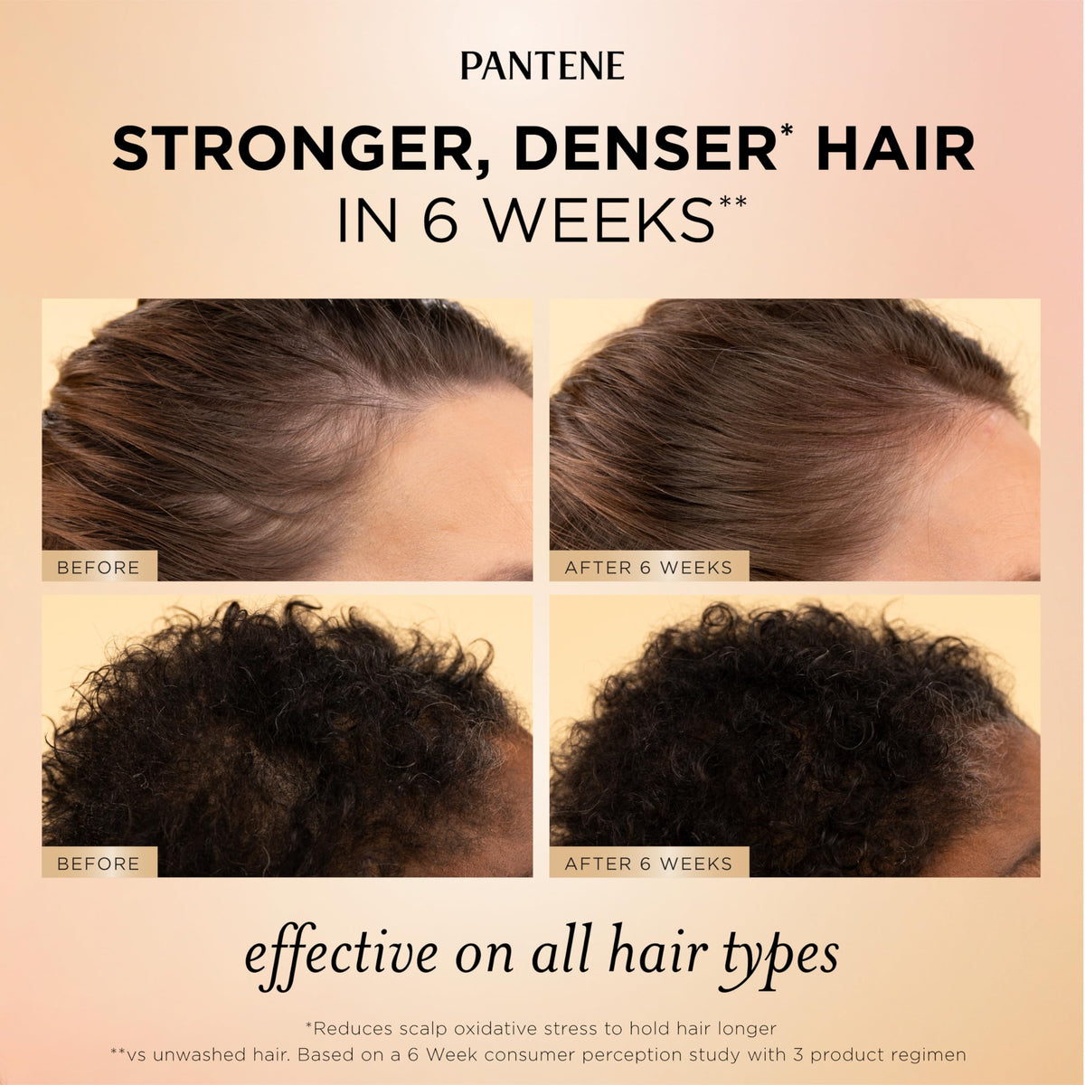 Pantene Abundant & Strong Daily Scalp Serum 2 oz with dropper