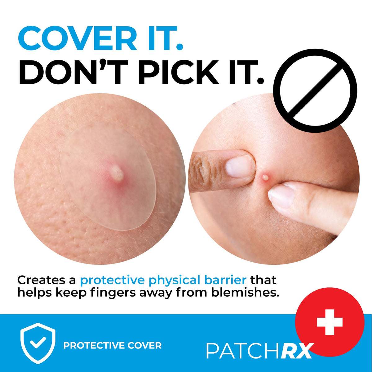 PatchRx Pimple Patches in use during night