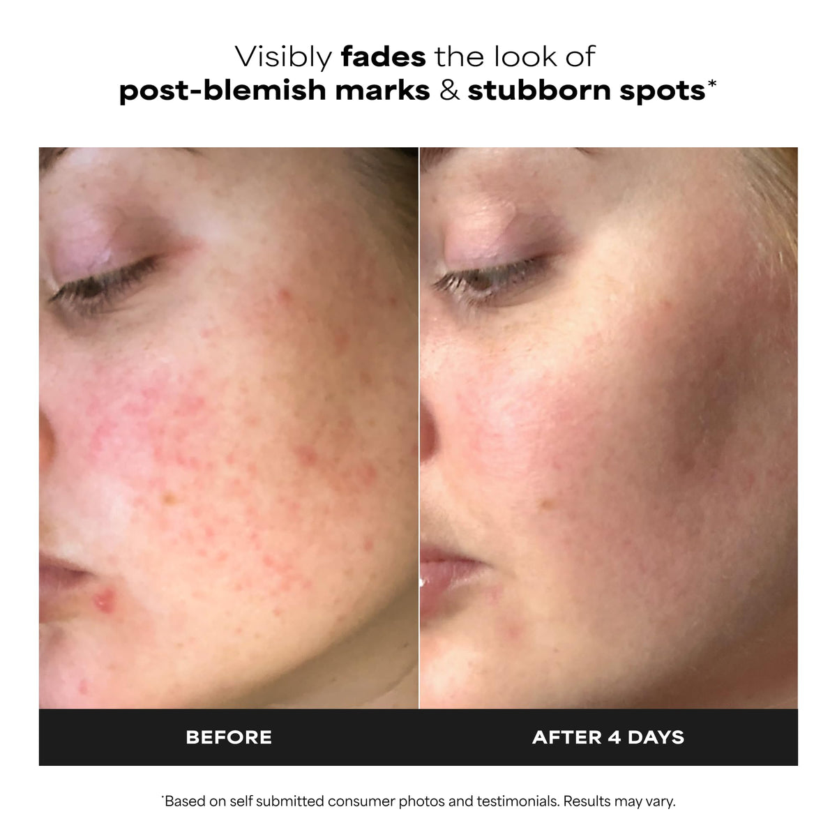 Paula's Choice 10% Azelaic Acid support Cream Gel packaging