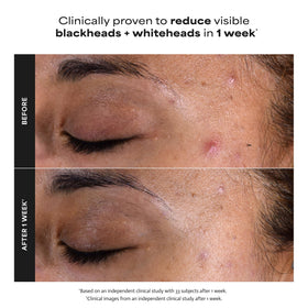Paula's Choice 2% BHA Liquid Exfoliant packaging details