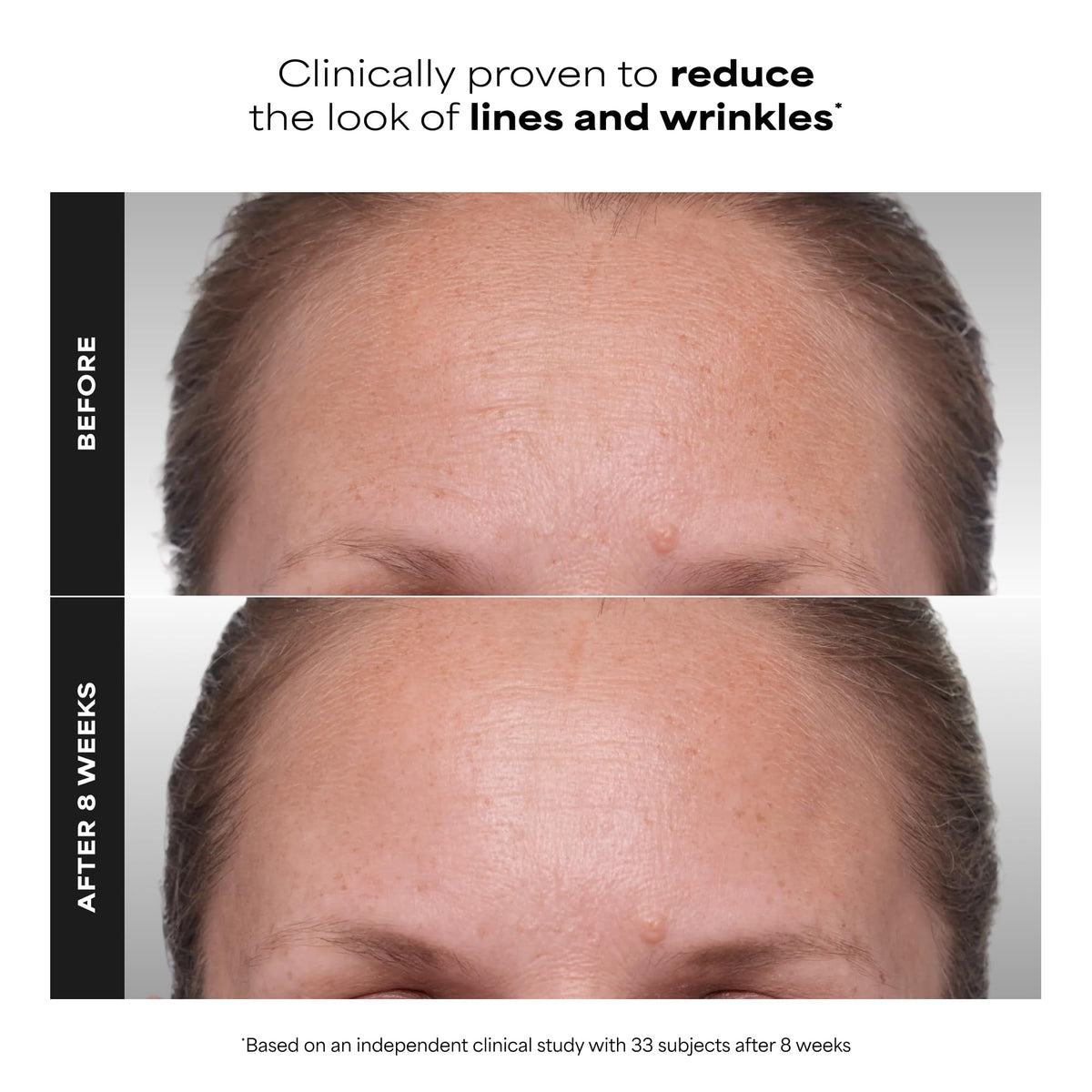 Paula's Choice CLINICAL 1% Retinol side view showing packaging