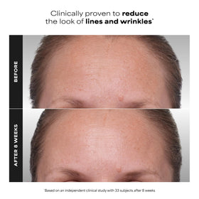 Paula's Choice CLINICAL 1% Retinol side view showing packaging