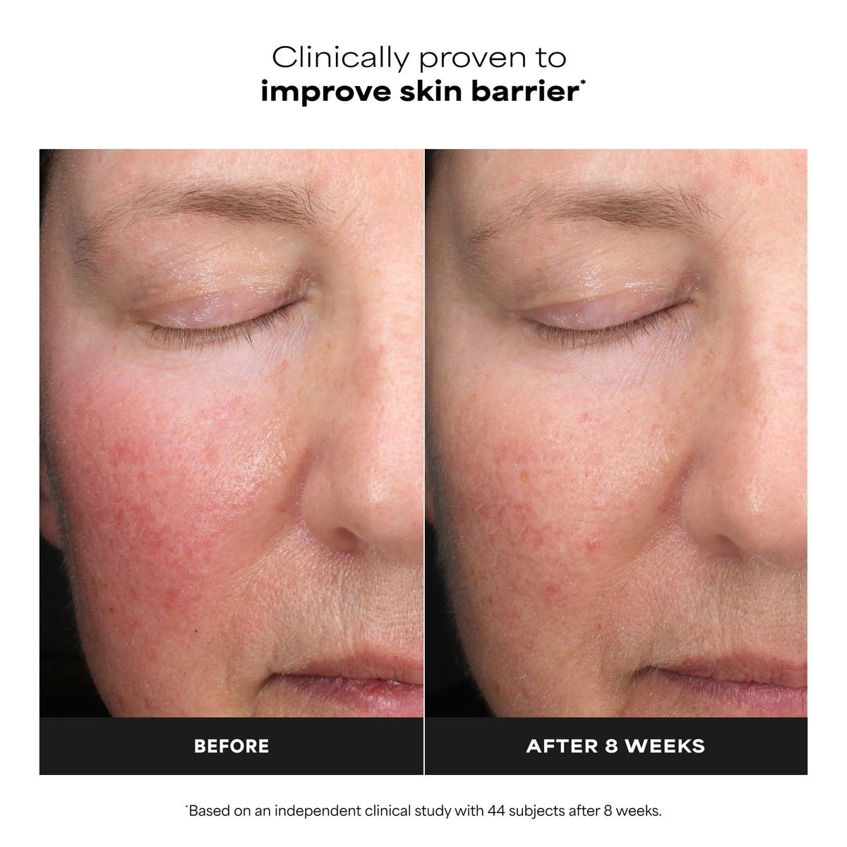 Paula's Choice exfoliant in a skincare routine setting
