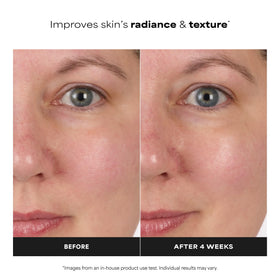 Paula's Choice Skin Balancing Toner application on cotton pad