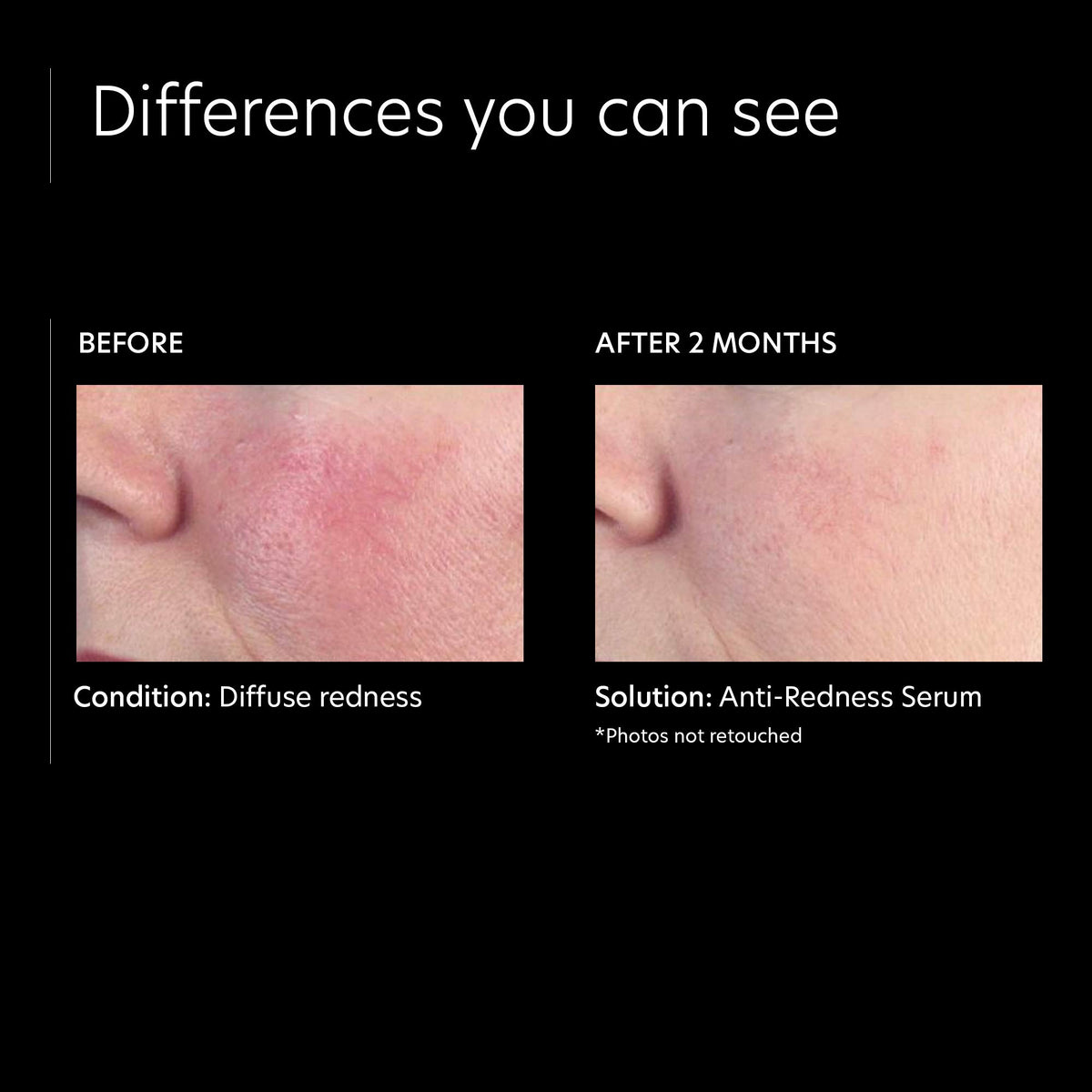 PCA SKIN Anti-Redness Face Serum packaging