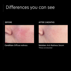 PCA SKIN Anti-Redness Face Serum packaging