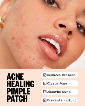 PEACE OUT Acne Healing Dots applied on skin