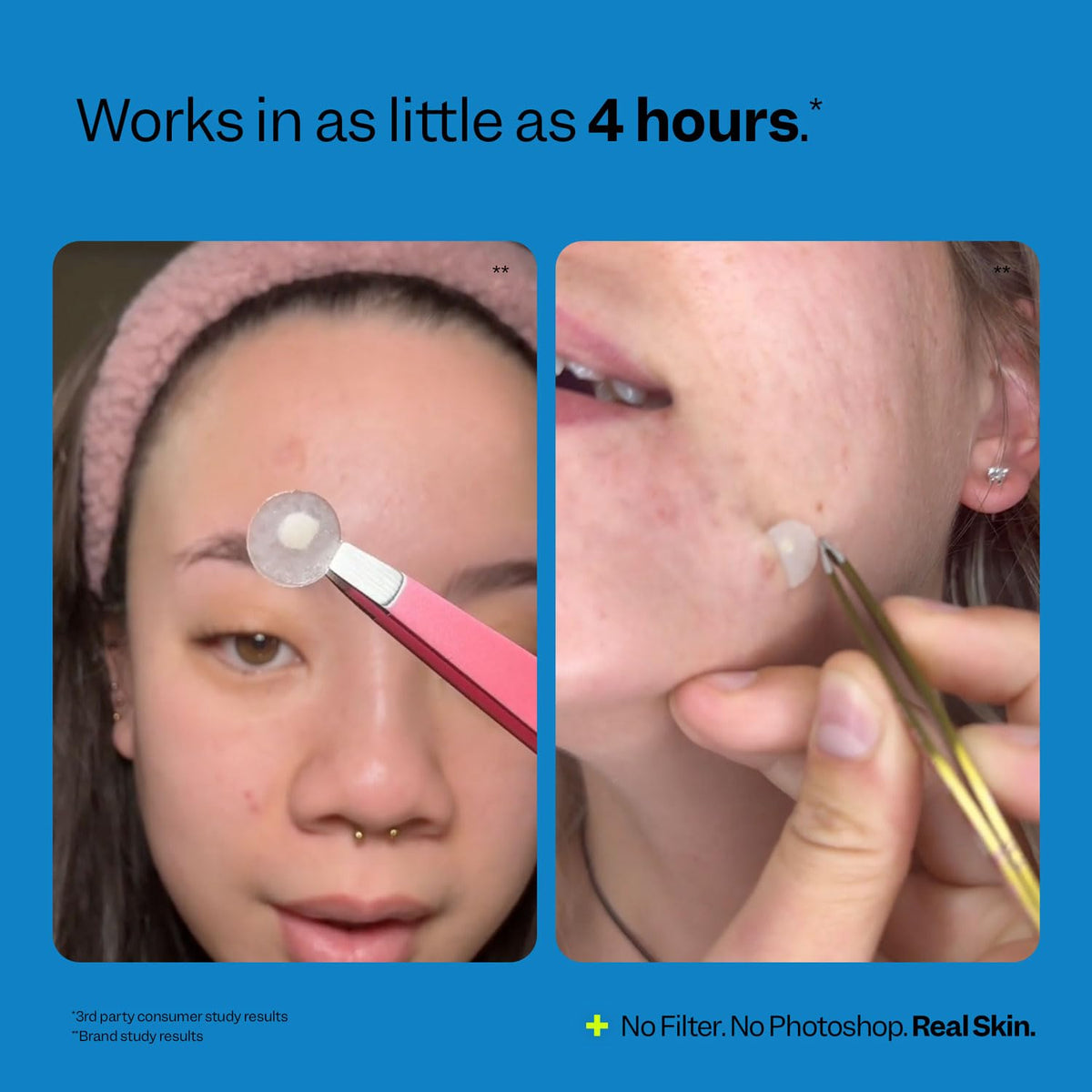 Peach Slices Acne Spot Dots with instructions