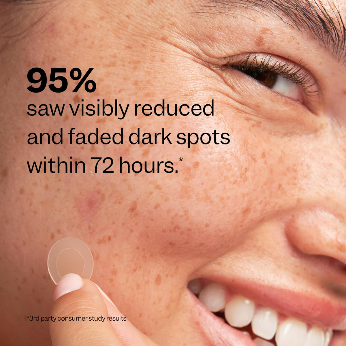 Peach Slices Dark Spot Microdarts in lifestyle setting