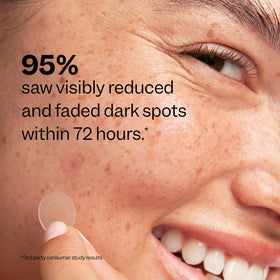 Peach Slices Dark Spot Microdarts in lifestyle setting