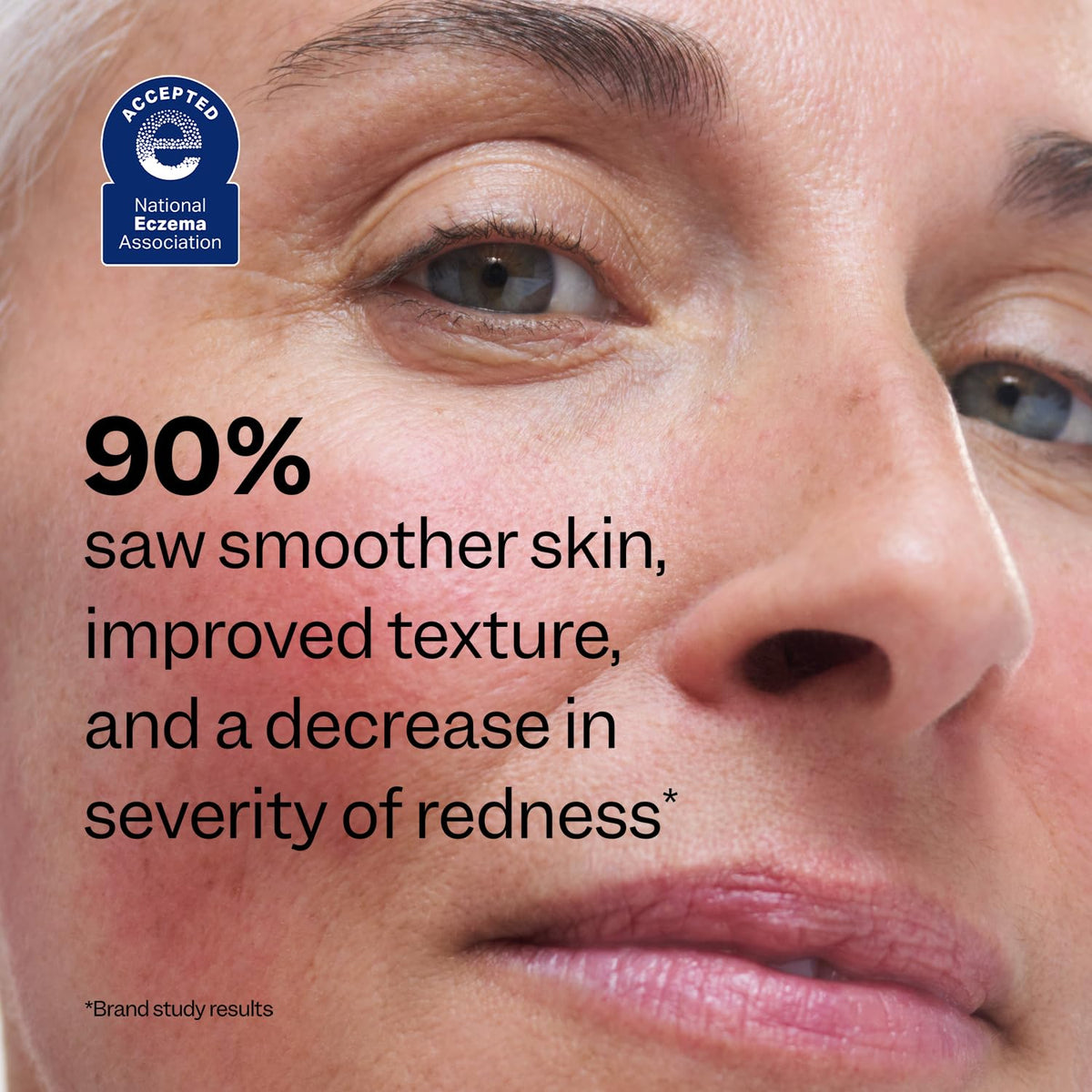Peach Slices Redness Relief Serum with skincare routine items