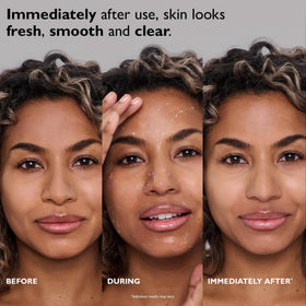 Peter Thomas Roth FIRMx Peeling Gel packaging