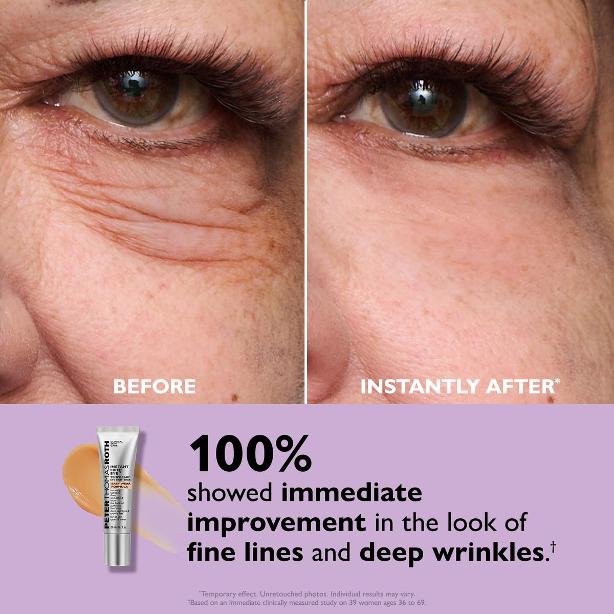 Peter Thomas Roth Instant FIRMx® Eye Tightener close-up of the tube