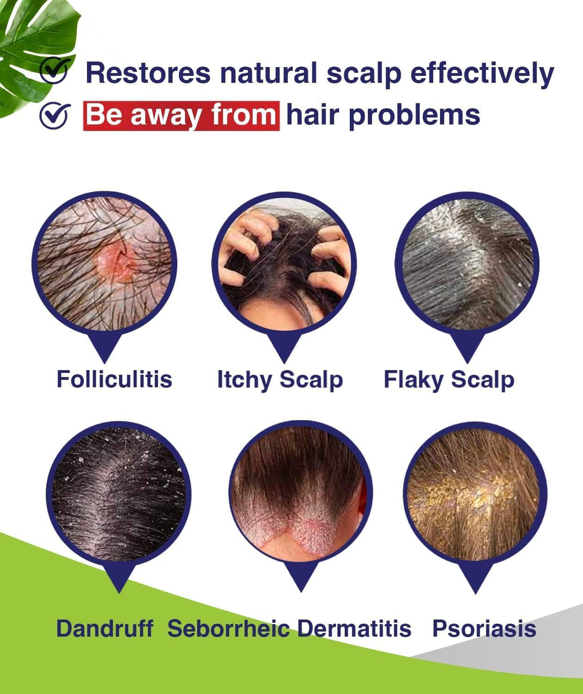 PHARMBANNER Anti-Fungal Shampoo back label with ingredients