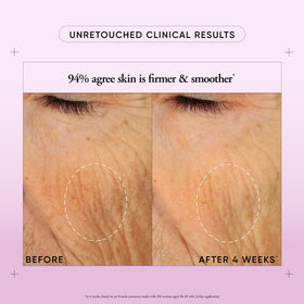 philosophy Purity One-Step Facial Cleanser application on skin