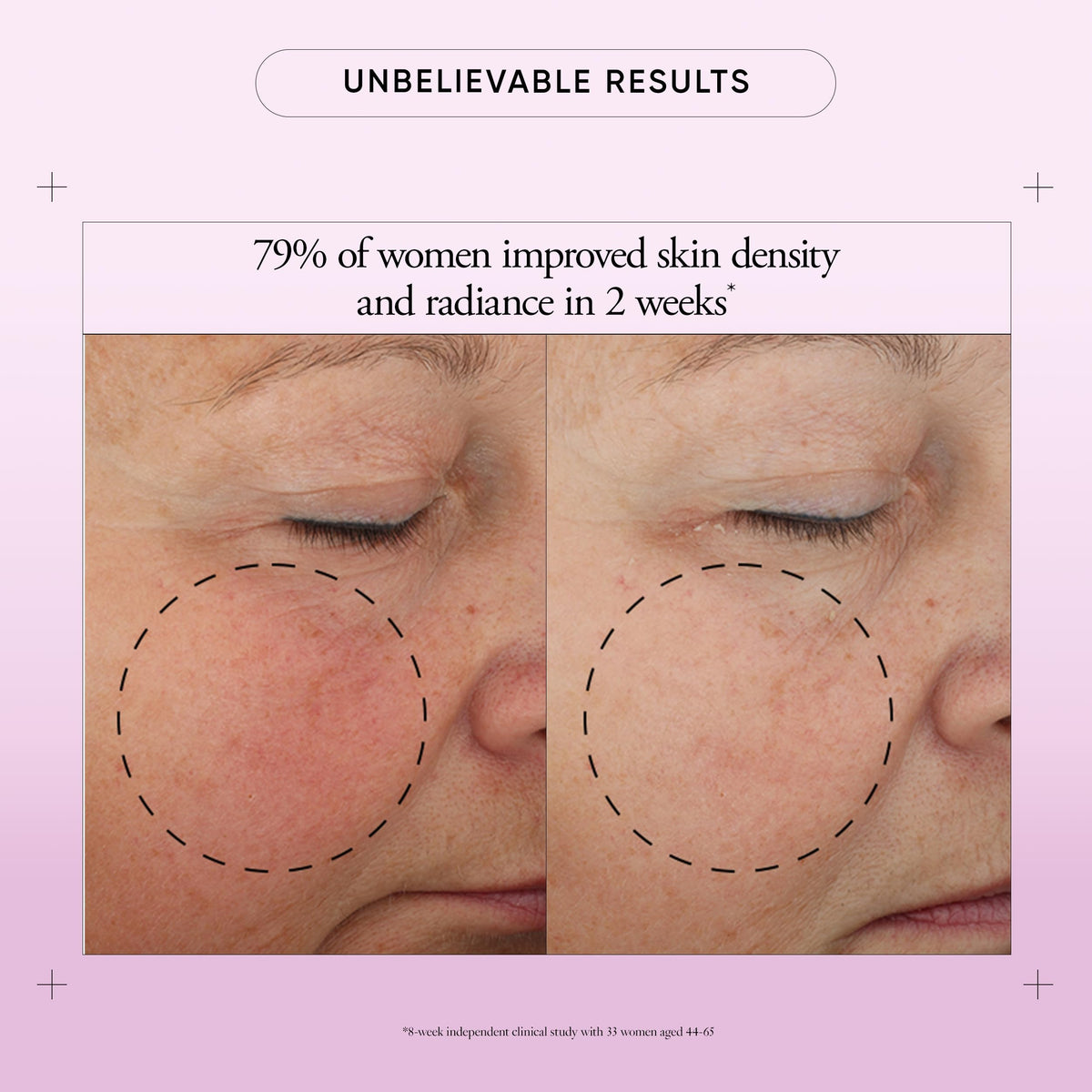 philosophy Ultimate Miracle Worker cream texture close-up