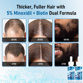 PickClub 5% Minoxidil Hair Regrowth Serum side view