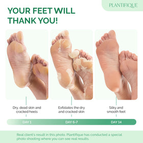 PLANTIFIQUE Foot Peeling Mask application process