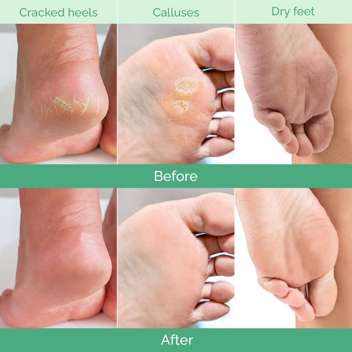 PLANTIFIQUE Foot Peeling Mask being applied on feet