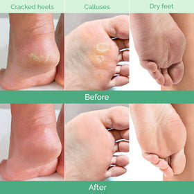 PLANTIFIQUE Lavender Foot Peeling Mask ingredients close-up