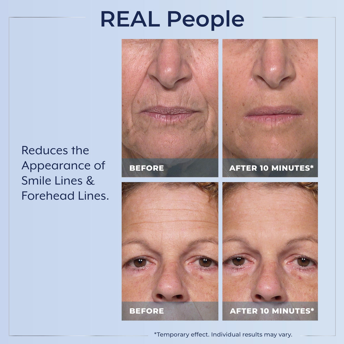 Plexaderm Rapid Reduction Serum application on skin