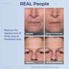 Plexaderm Rapid Reduction Serum application on skin