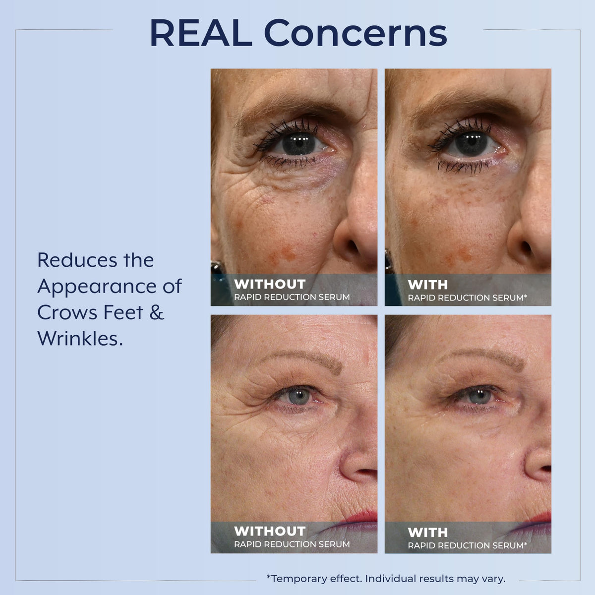 Plexaderm Rapid Reduction Serum packaging