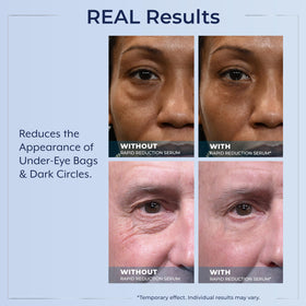 Plexaderm Rapid Reduction Serum texture on fingertip