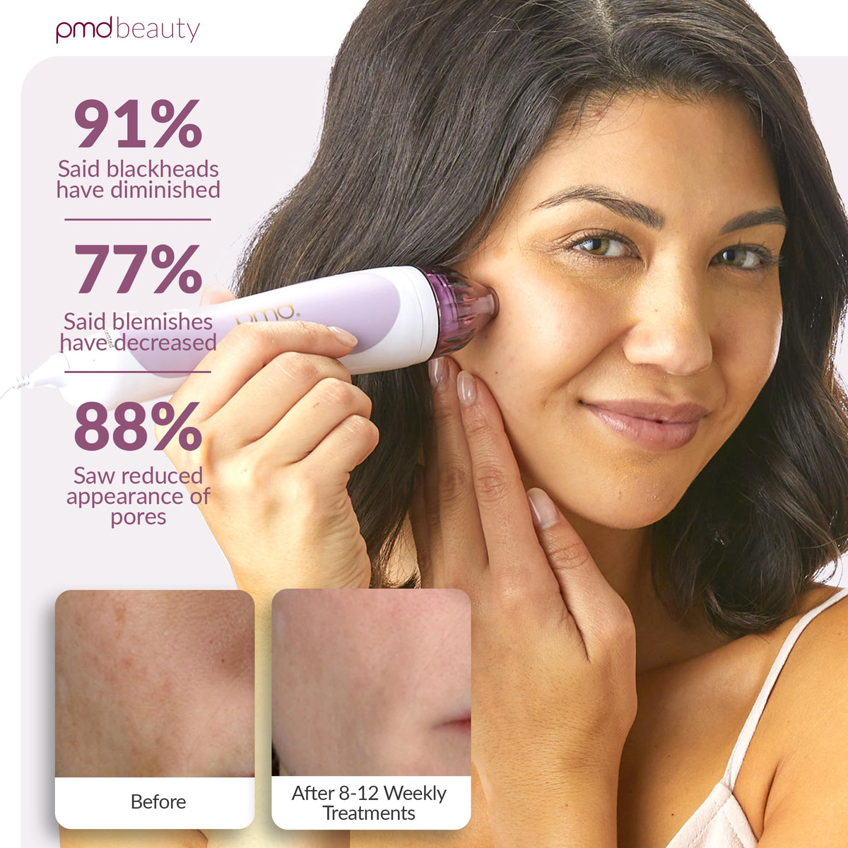 PMD Beauty Personal Microderm Classic device side view with lavender finish