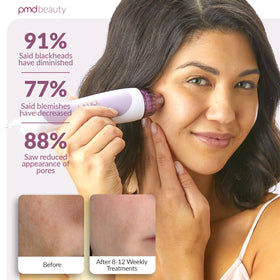 PMD Beauty Personal Microderm Classic device side view with lavender finish