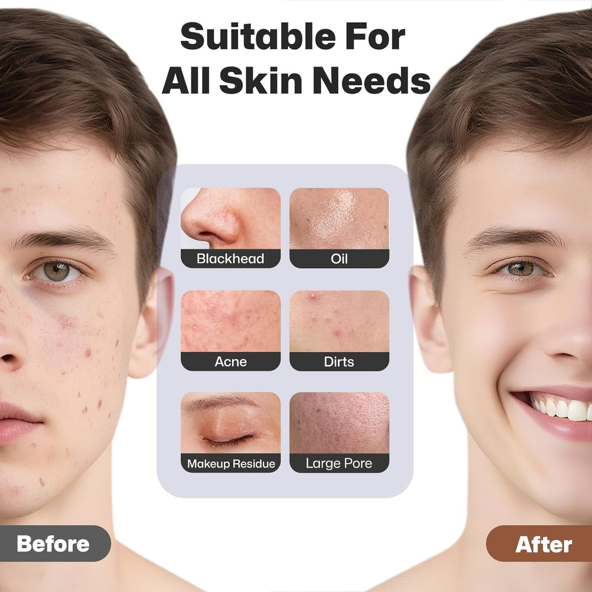 PRITECH Facial Cleansing Brush in use on a model's face