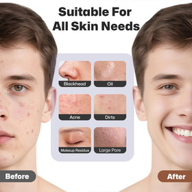PRITECH Facial Cleansing Brush in use on a model's face