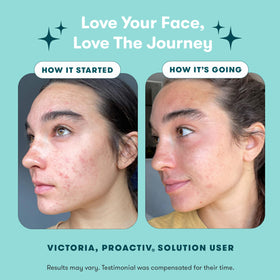 Proactiv Renewing Cleanser bottle close-up