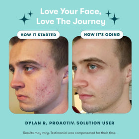 Proactiv Zits Happen Patches packaging