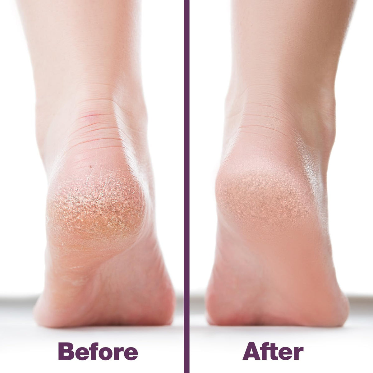 Probelle foot file held in hand demonstrating grip