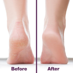 Probelle foot file held in hand demonstrating grip