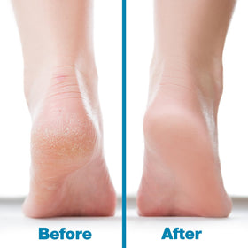 Probelle Nickel Foot File packaging