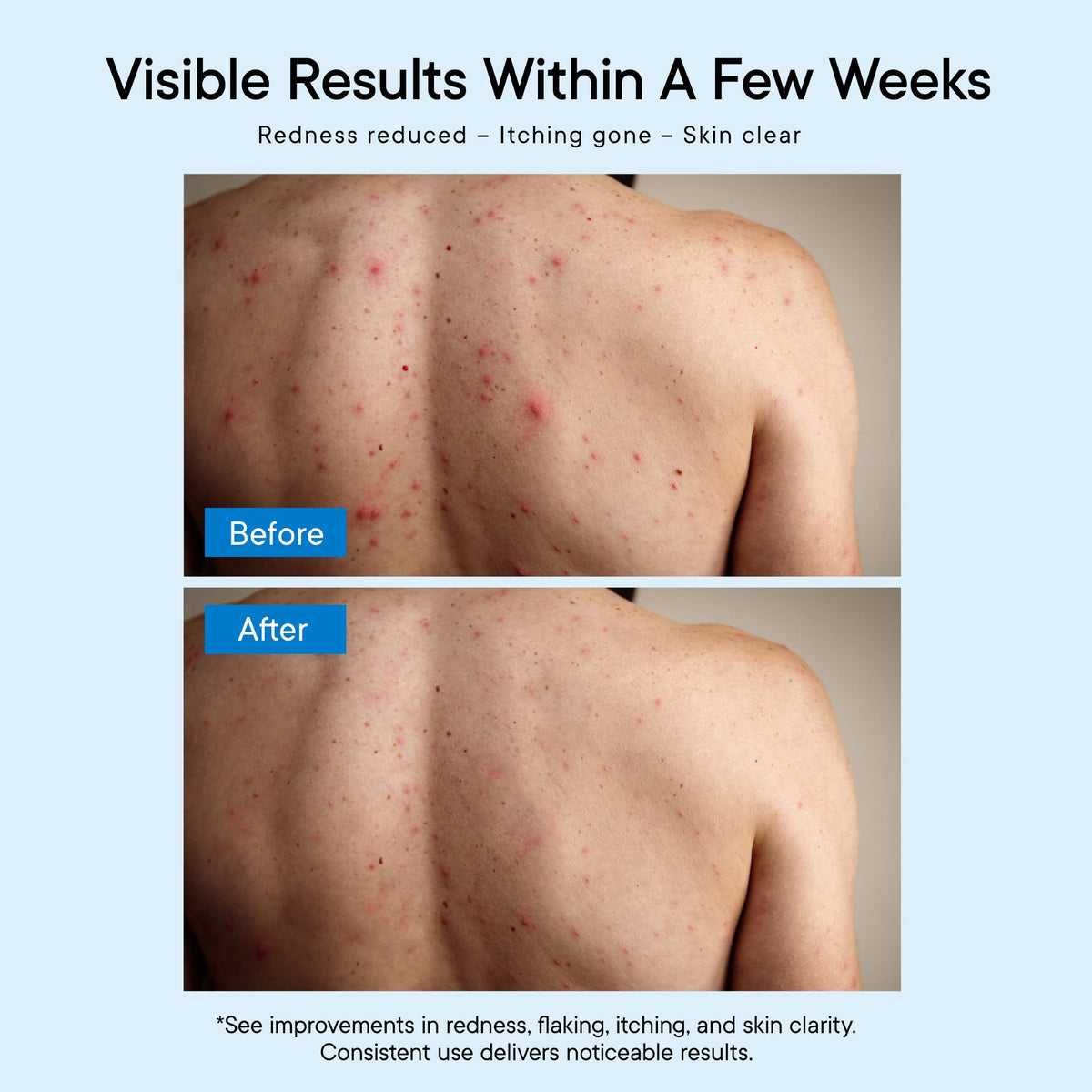 ProBliva Antifungal Body Wash 740g side view