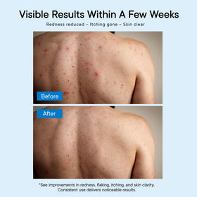 ProBliva Antifungal Body Wash 740g side view