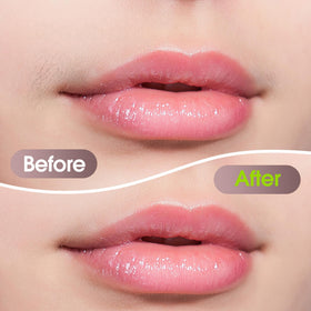Profeir Facial Hair Removal Device side view showcasing the dual-blade design