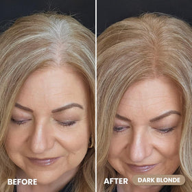 PROMETICS Instant Coverage Hairline Powder Dark Blonde packaging
