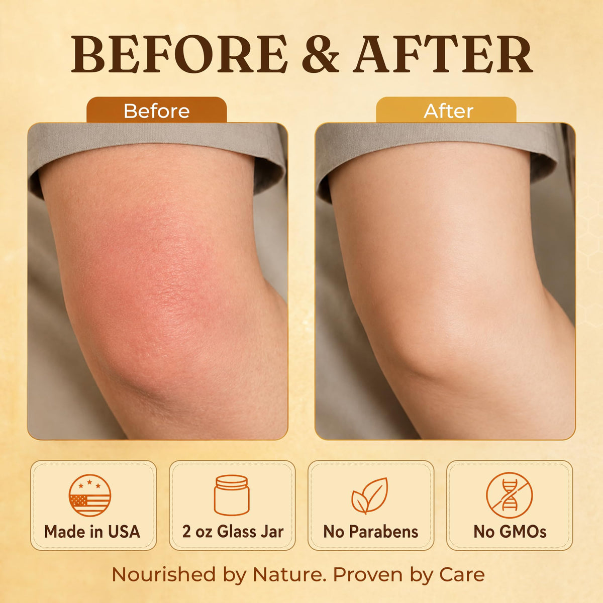 ProSeed Manuka Honey Tallow Balm applied on skin
