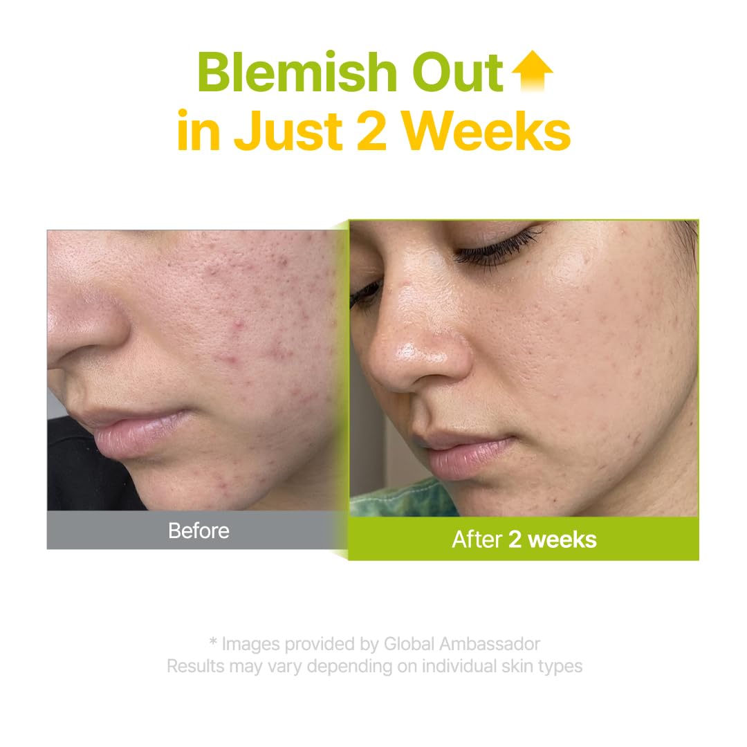 PURITO Azelaic 10% Kojic Serum application on skin
