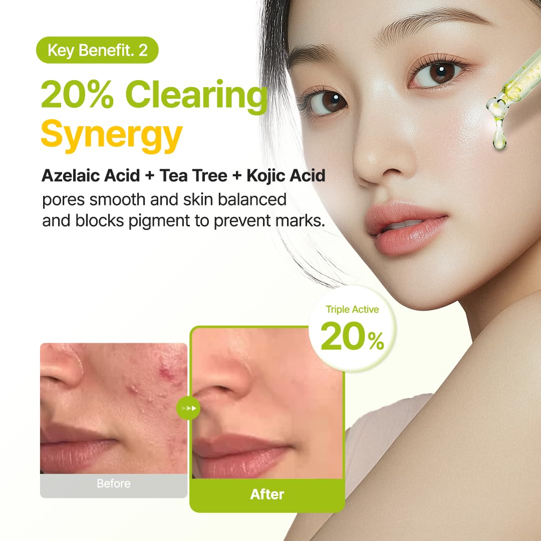 PURITO Azelaic 10% Kojic Serum in skincare routine
