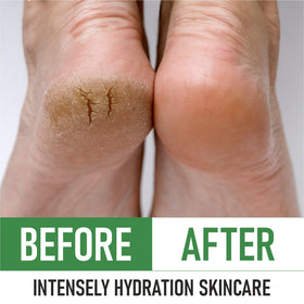 PurOrganica Urea Cream 40% lifestyle scene