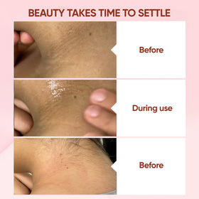 QUARXERY exfoliating gel applied on hand
