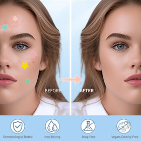 QUSTERE Pimple Patches various colours display