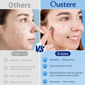 QUSTERE pimple patches with natural ingredients displayed