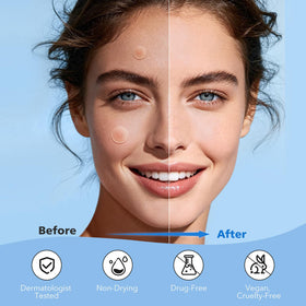 QUSTERE Pimple Patches with tea tree oil and salicylic acid ingredients